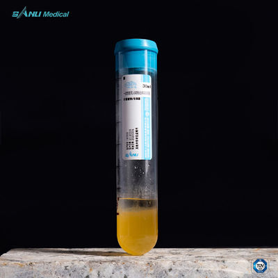 Alivie el tubo de ensayo 20ml ACD-A del dolor PRP con el GEL para el tratamiento del OA